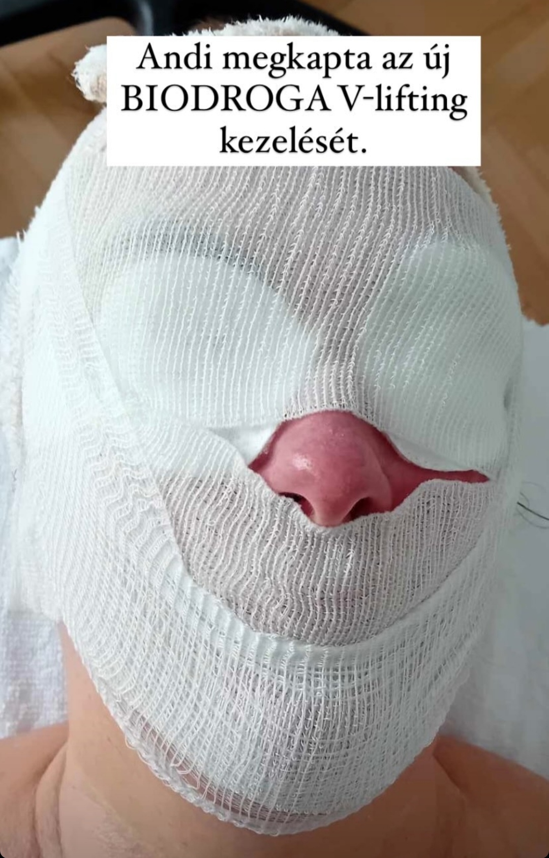 forrás: BIODROGA HU